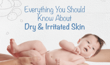 everything about dry irritated baby skin
