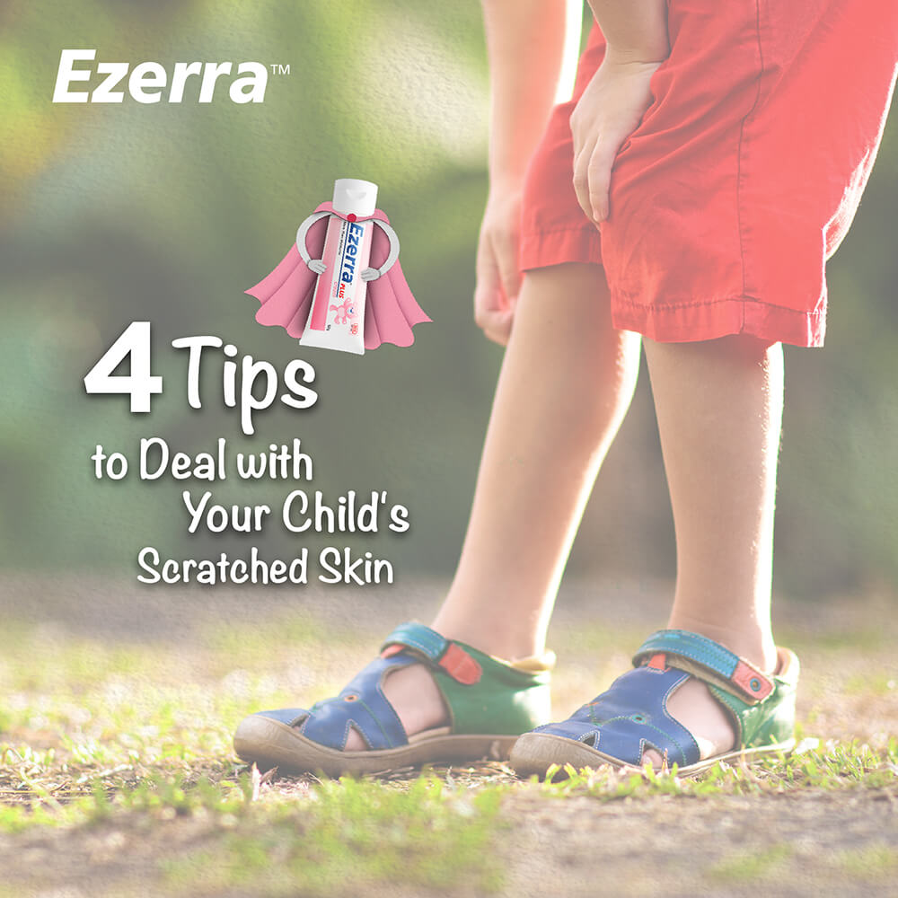 Deal with child's scratched dry skin