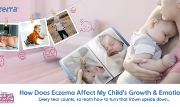 How Does Eczema Affect My Child's Growth & Emotion?