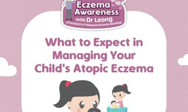 Managing Child's Eczema